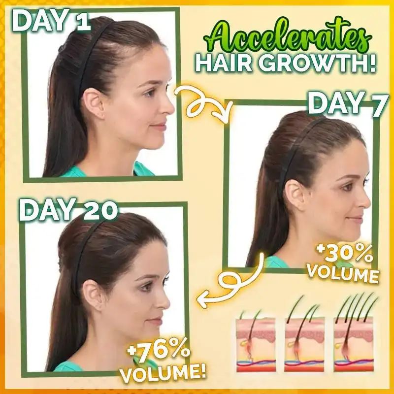 10X-Regro Strong Hair Serum - Image 2