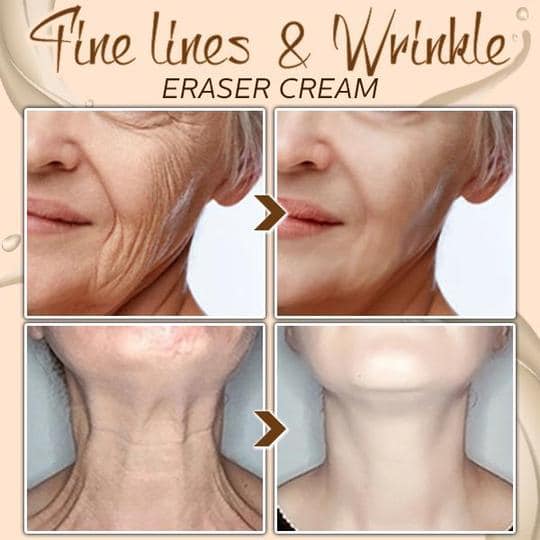 Snake Active Erase Cream Solution - Image 2