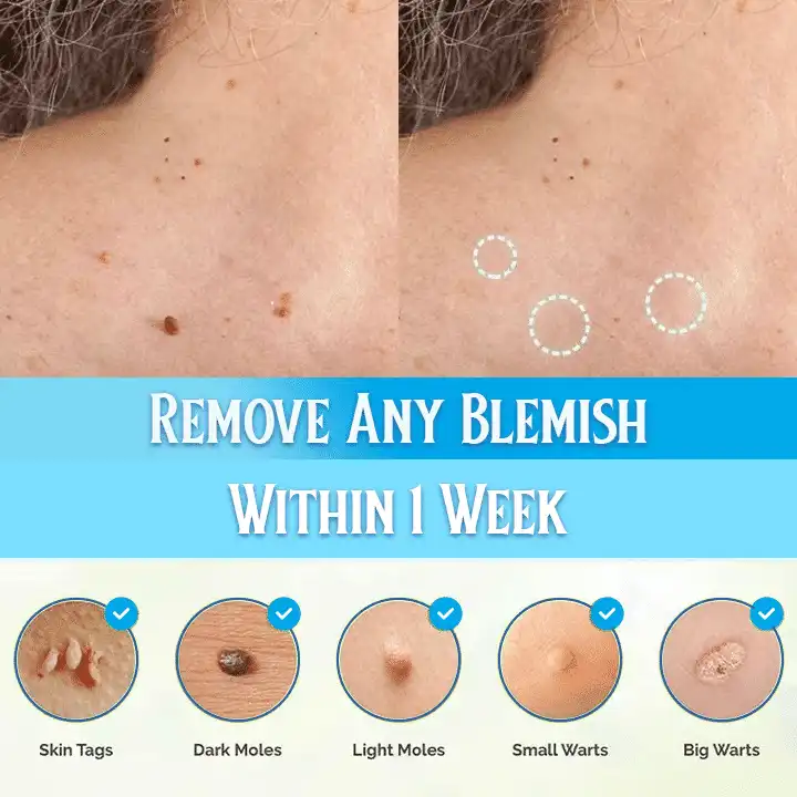 Pro Aqua Blemish Cream - Image 3