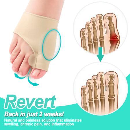 NATURFEET Bunion Corrector - Image 2