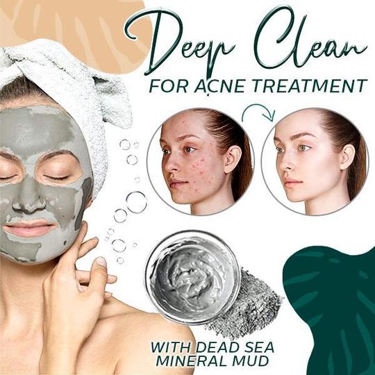 Beauty Volcanic Mud Bath Dew - Image 3