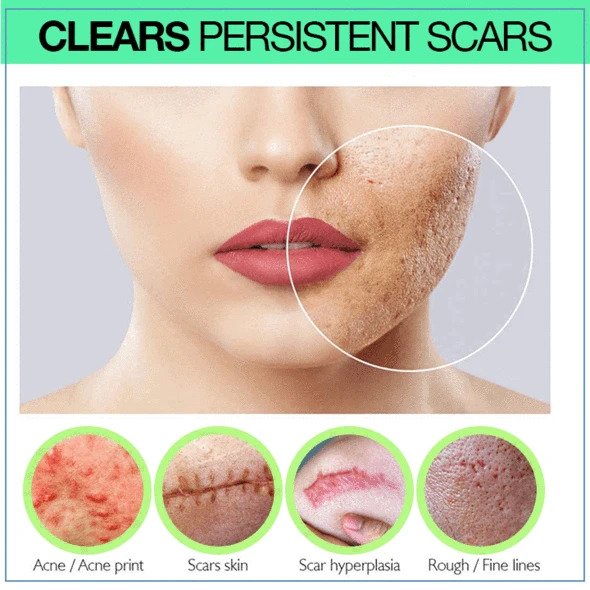 PRO Niacinamide Scar Serum - Image 3