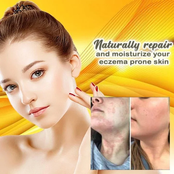 Herbal Skin Solutions Cream - Image 3