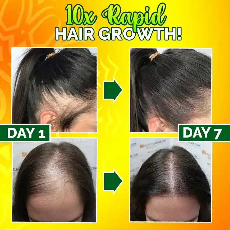 10X-Regro Strong Hair Serum - Image 3