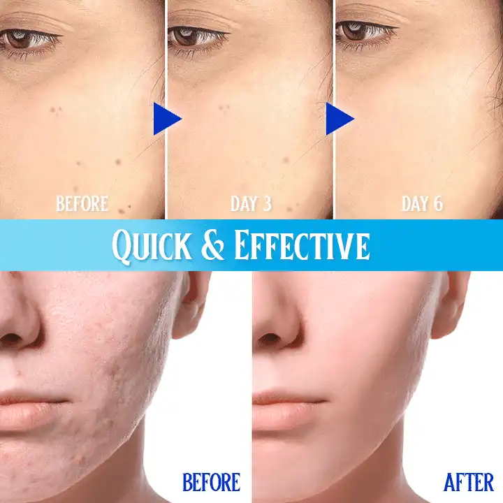 Pro Aqua Blemish Cream - Image 4
