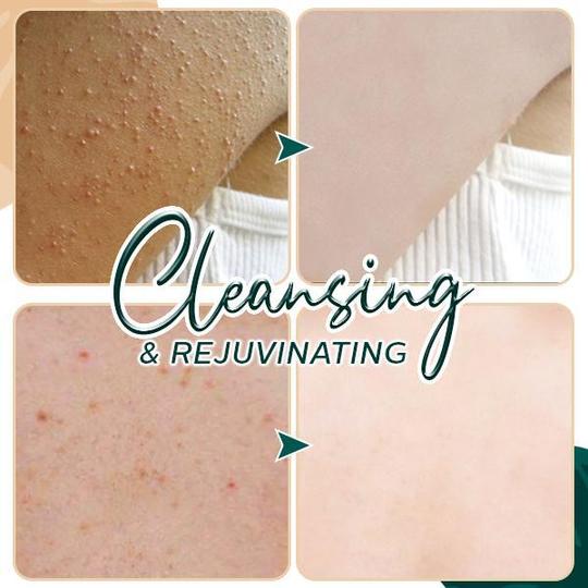 Beauty Volcanic Mud Bath Dew - Image 4