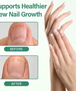 Alcuras® Nail Detox Penetration Serum Pen