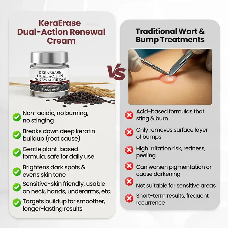 KeraErase Dual-Action Renewal Cream - Image 3