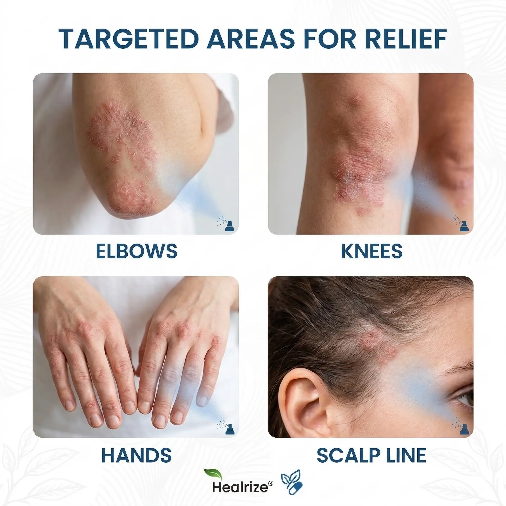 Herbalonix® Magnesium Botanical Spray