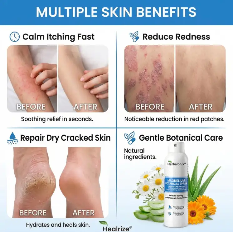 Herbalonix® Magnesium Botanical Spray