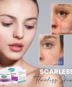 Medease Skin Rebound Cream