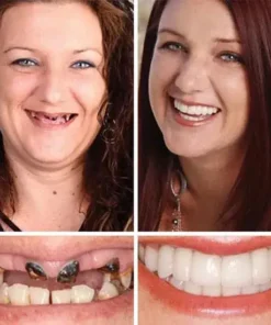 Meleval® Medical Full Denture with Strong Suctiond