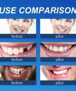 Meleval® Medical Full Denture with Strong Suctiond