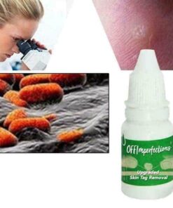 OFFImperfections Upgraded Skin Tag Removal