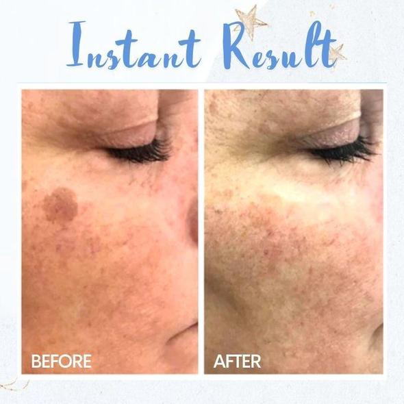 Spot Removal Pen - Image 3