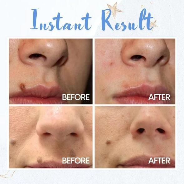 Spot Removal Pen - Image 2