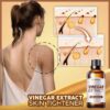 Vinegar Extract Skin Tightener