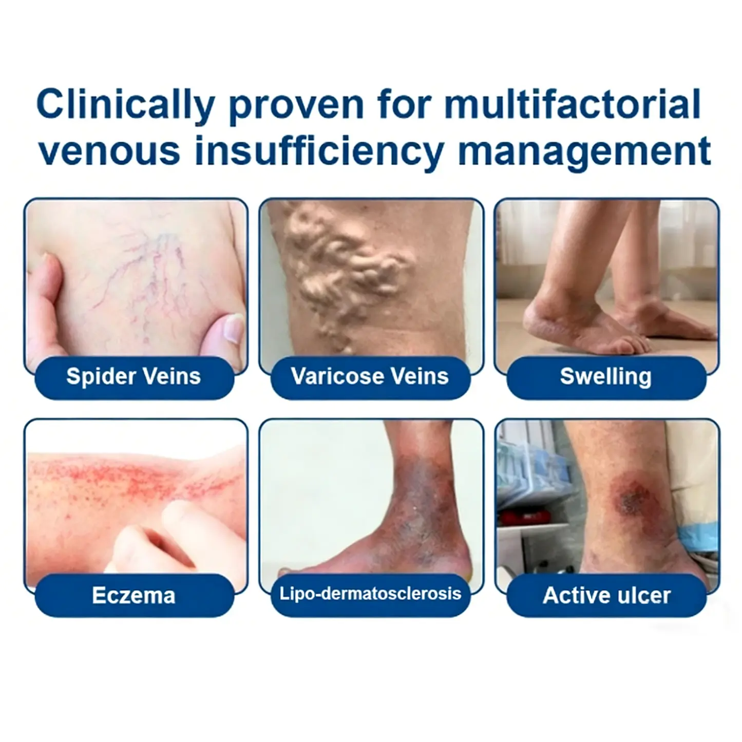 ๐ฝ๐ฒ๐ถ๐ฃ ๐พ๐จ๐ง๐๐ผ๐ช๐ง ๐๐๐๐ซ๐๐๐๐ฒ๐ฑ๐น๐ ๐๐๐ญ๐๐ - Image 3