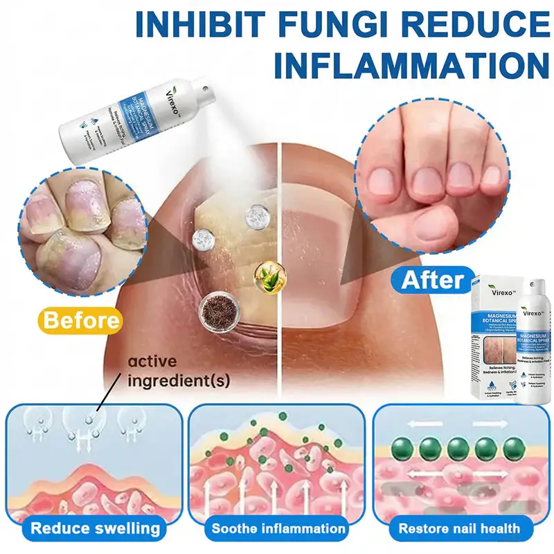 Magnesium Botanical Spray - Image 4