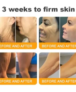 ZAMORAES™ Bee Poison2.0 Skin Restoration Cream