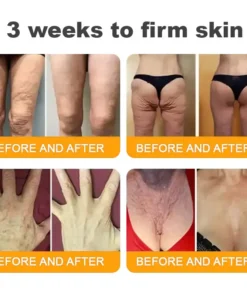 ZAMORAES™ Bee Poison2.0 Skin Restoration Cream