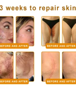 ZAMORAES™ Bee Poison2.0 Skin Restoration Cream