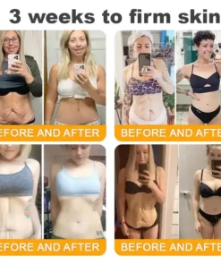 ZAMORAES™ Bee Poison2.0 Skin Restoration Cream